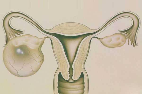 宫颈粘连怀孕了_子宫切除怎么生育_什么叫试管婴儿图片？具体流程该怎么做？
